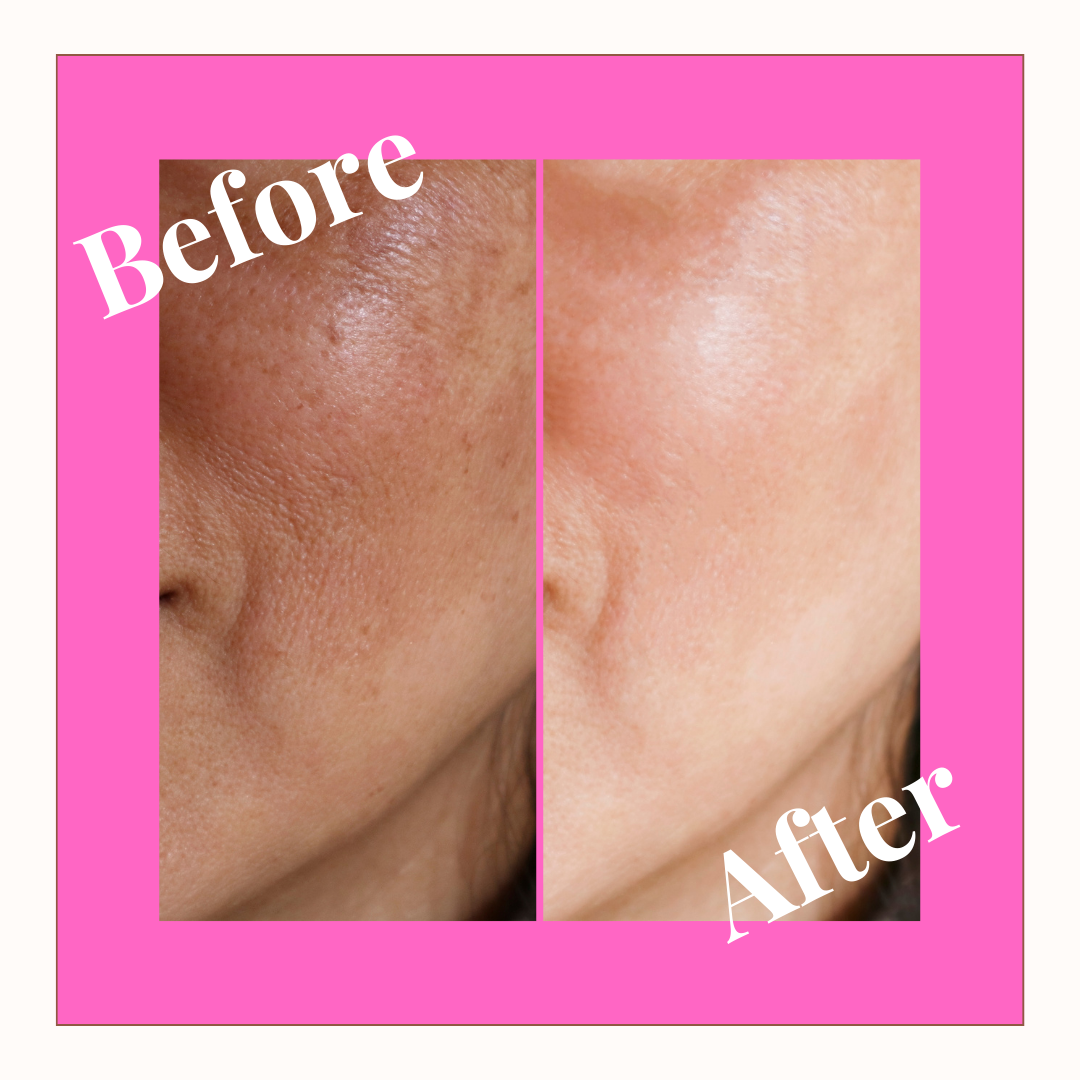 Skin Sculpt Pro™ | Face Massager